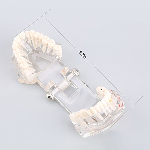 Yosoo Transparent Typodont Dental Zähne Lehr-Studie-Modell Mündliche Abnehmbare Dental-Pädagogisches Modell -
