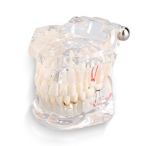 Yosoo Transparent Typodont Dental Zähne Lehr-Studie-Modell Mündliche Abnehmbare Dental-Pädagogisches Modell -